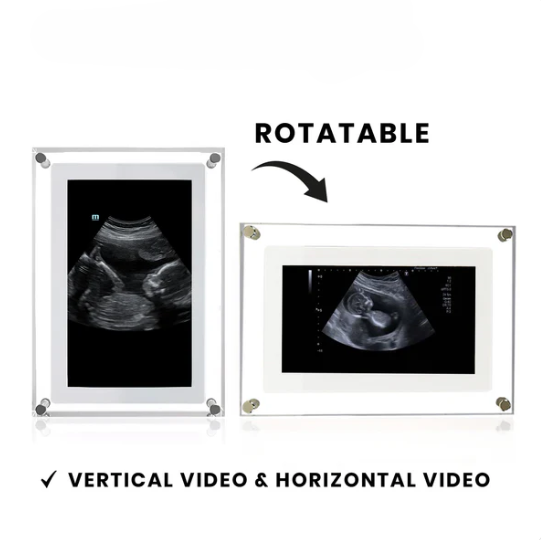SnapFrame™ Digital Frame